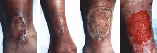 Sünger Kullanım Örnekleri